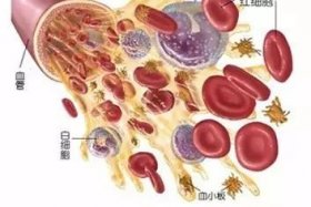 中性粒细胞低到什么程度是白血病